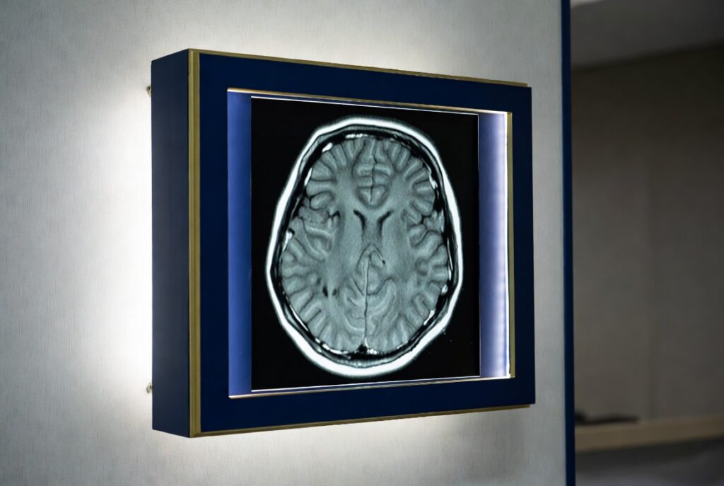 Brain imaging used as evidence in a San Francisco pedestrian traumatic brain injury case